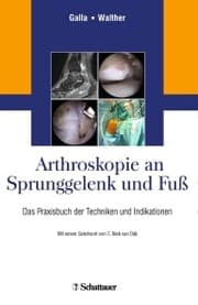 Cover von Arthroskopie an Sprunggelenk und Fuß