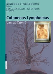 Cover von Cutaneous Lymphomas