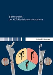 Cover von Biomechanik der Hüft-Revisionsendoprothese