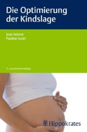 Cover von Die Optimierung der Kindslage