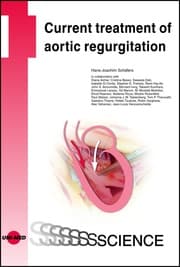 Cover von Current treatment of aortic regurgitation