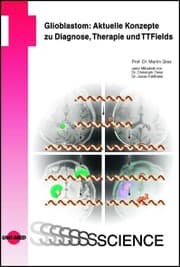 Cover von Glioblastom: Aktuelle Konzepte zu Diagnose, Therapie und TTFields