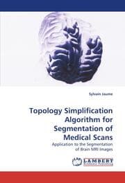 Cover von Topology Simplification Algorithm for Segmentation of Medical Scans