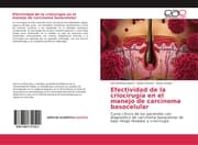 Cover von Efectividad de la criocirugía en el manejo de carcinoma basocelular