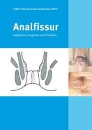 Cover von Analfissur