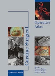 Cover von Cardiac Surgical Operative Atlas