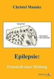 Cover von Epilepsie: Protokoll einer Heilung