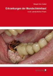 Cover von Erkrankungen der Mundschleimhaut in der zahnärztlichen Praxis