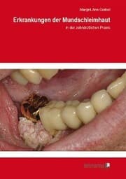 Cover von Erkrankungen der Mundschleimhaut