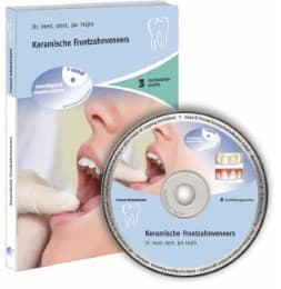 Cover von Keramische Frontzahnveneers