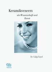 Cover von Keramikveneers als Wissenschaft und Kunst