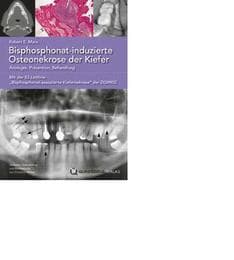 Cover von Bisphosphonat-induzierte Osteonekrose der Kiefer