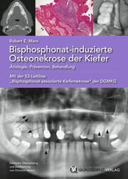 Cover von Bisphosphonat-induzierte Osteonekrose der Kiefer