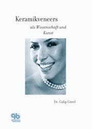 Cover von Keramikveneers als Wissenschaft und Kunst