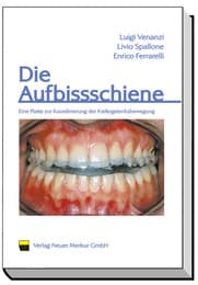 Cover von Die Aufbissschiene