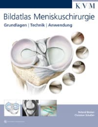 Cover von Bildatlas Meniskuschirurgie