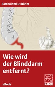 Cover von Wie wird der Blinddarm entfernt?