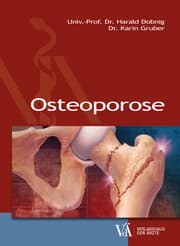 Cover von Osteoporose