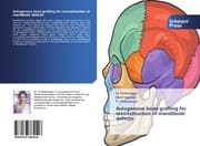 Cover von Autogenous bone grafting for reconstruction of mandibular defects