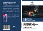 Cover von Management des vollständig zahnlosen Unterkiefers mit Implantaten
