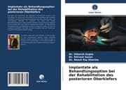 Cover von Implantate als Behandlungsoption bei der Rehabilitation des posterioren Oberkiefers