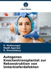 Cover von Autogenes Knochentransplantat zur Rekonstruktion von Unterkieferdefekten