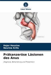 Cover von Präkanzeröse Läsionen des Anus