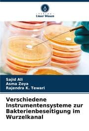Cover von Verschiedene Instrumentensysteme zur Bakterienbeseitigung im Wurzelkanal