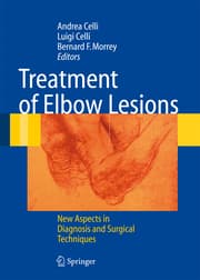 Cover von The Treatment of the Elbow Lesions