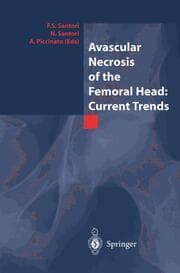 Cover von Avascular Necrosis of the Femoral Head: Current Trends