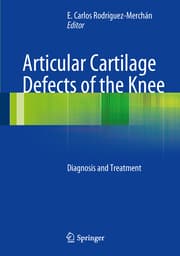 Cover von Articular Cartilage Defects of the Knee
