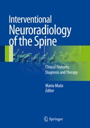 Cover von Interventional Neuroradiology of the Spine