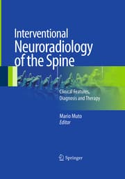 Cover von Interventional Neuroradiology of the Spine