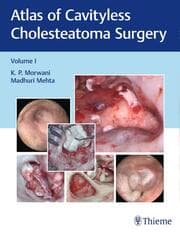 Cover von Atlas of Cavityless Cholesteatoma Surgery, Vol 1