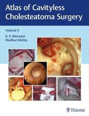 Cover von Atlas of Cavityless Cholesteatoma Surgery, Vol 2