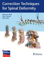 Cover von Correction Techniques for Spinal Deformity