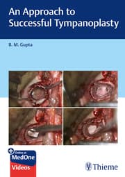 Cover von An Approach to Successful Tympanoplasty