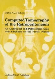 Cover von Computed Tomography of the Retroperitoneum