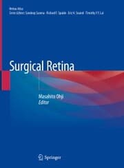 Cover von Surgical Retina