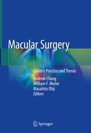 Cover von Macular Surgery