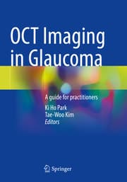 Cover von OCT Imaging in Glaucoma