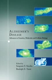 Cover von Alzheimer's Disease