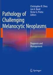 Cover von Pathology of Challenging Melanocytic Neoplasms