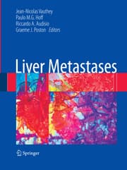 Cover von Liver Metastases