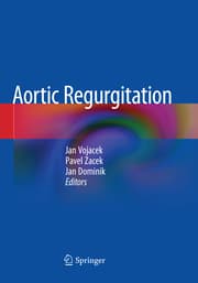 Cover von Aortic Regurgitation