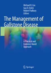 Cover von The Management of Gallstone Disease