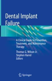 Cover von Dental Implant Failure