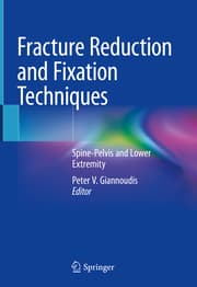 Cover von Fracture Reduction and Fixation Techniques