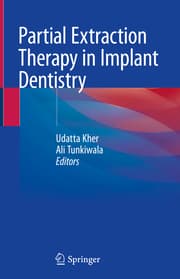 Cover von Partial Extraction Therapy in Implant Dentistry