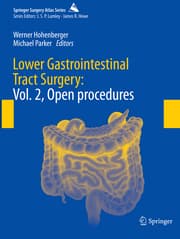 Cover von Lower Gastrointestinal Tract Surgery